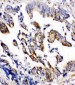 Anti-Beta Arrestin 2 Antibody